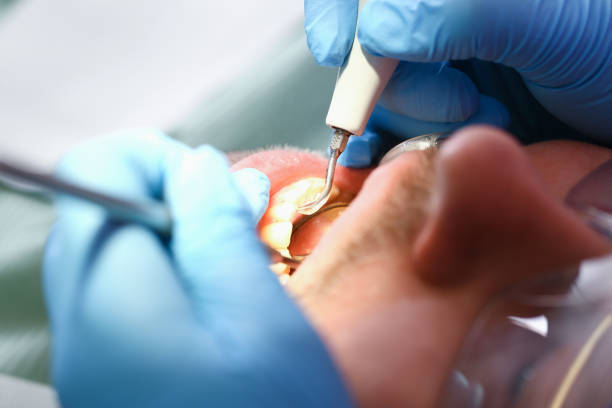 Best Urgent Dental Care for Toothaches in Mckinney, TX