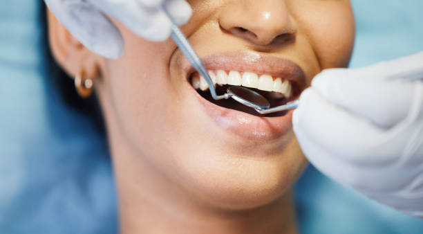 Best Emergency Root Canal Therapy in Mckinney, TX