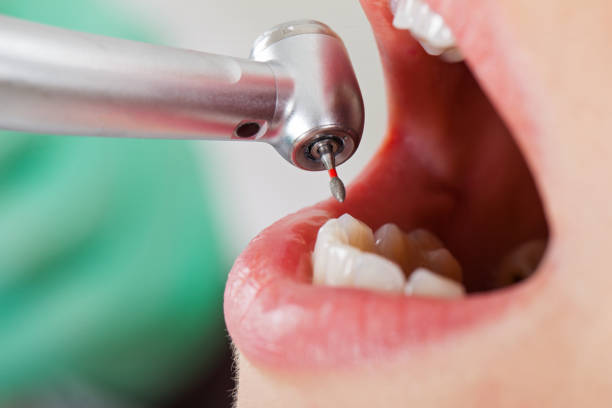 Best Emergency Pediatric Dental Care in Mckinney, TX